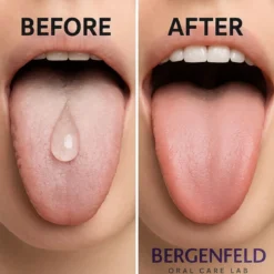 Bergenfeld® Tongue Clean Serum