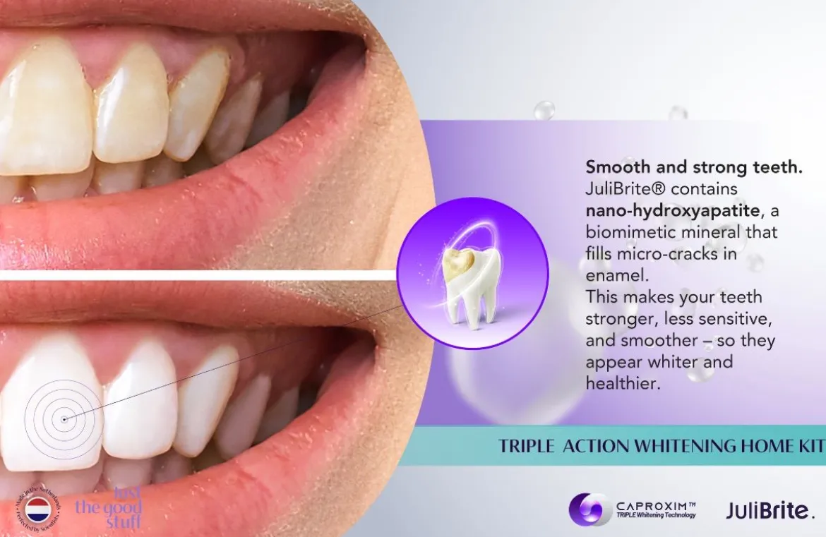 JuliBrite® Whitening Kit Voor Thuis Tanden Bleken
