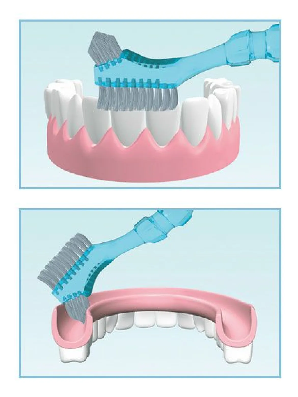 Miradent Protho Brush De Luxe Prothese Borstel