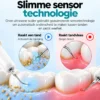 Oral Icon® Elektrische Tandsteen Verwijderaar