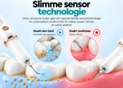 Oral Icon® Elektrische Tandsteen Verwijderaar