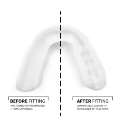SOVA® Aero 3D-gevormd Tandenknarsbitje Met Case (2.0 mm)