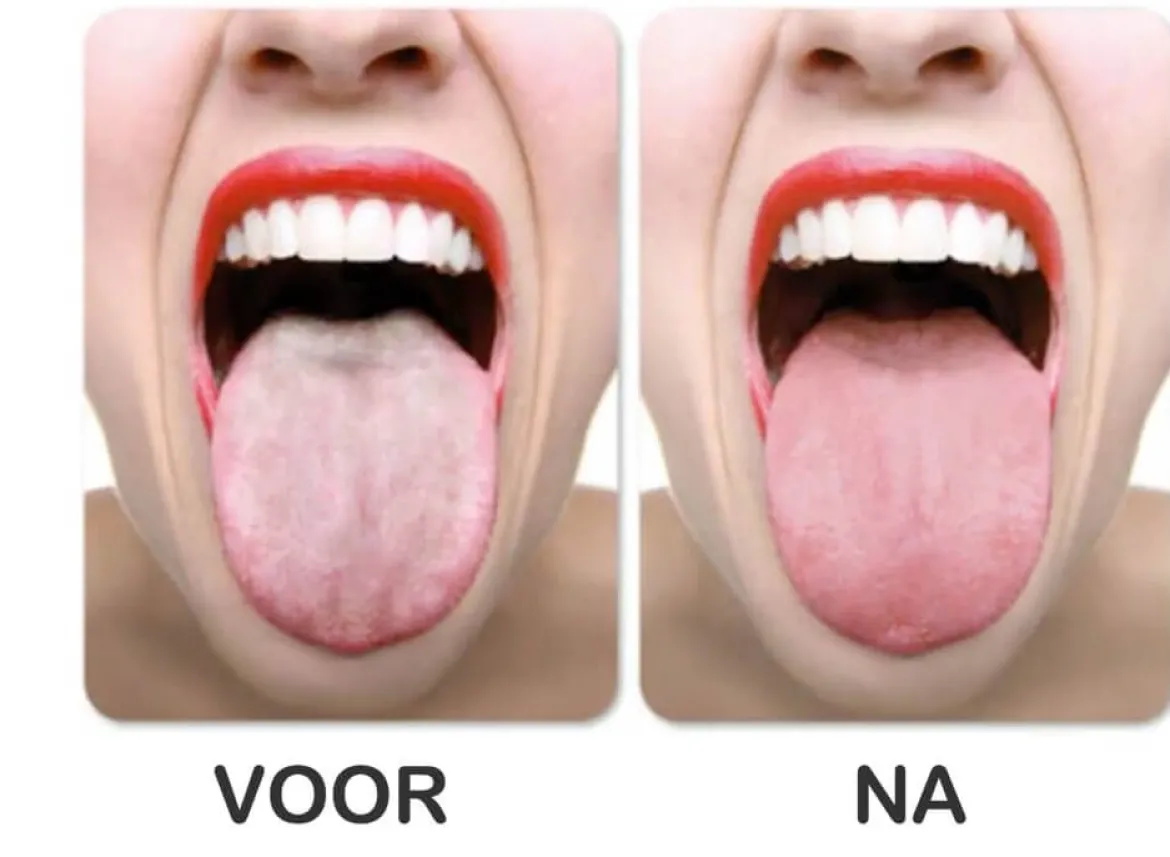 Tongue Clean Voordeelkit